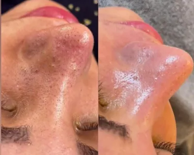 فشیال تخصصی در اصفهان