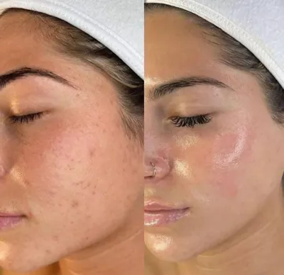 فشیال تخصصی در اصفهان