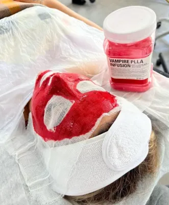 فشیال تخصصی در اصفهان