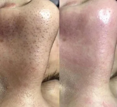 فشیال تخصصی در اصفهان