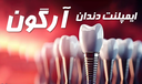 ایمپلنت آلمانی