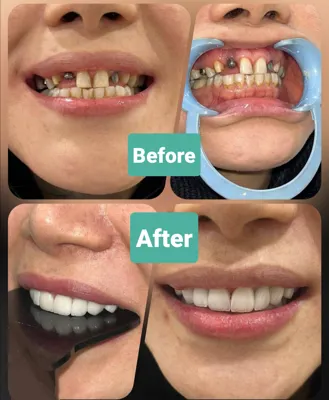 خدمات ایمپلنت در افسریه