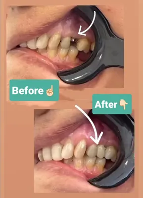 کلینیک ایمپلنت در افسریه