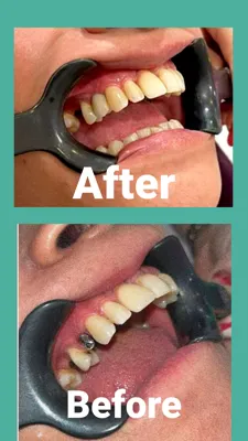 ایمپلنت اقساط در افسریه