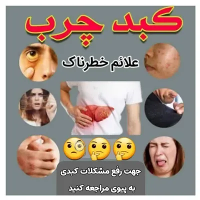 با علائم کبد چرب آشنا شوید