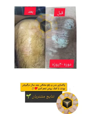 نتایج مشتریان