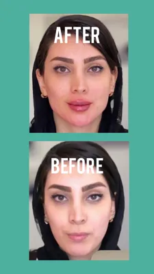 بهترین کلینیک تخصصی زیبایی در سنندج