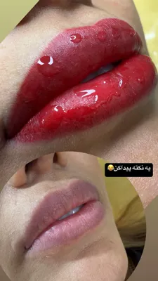 شیدینگ لب در تهران