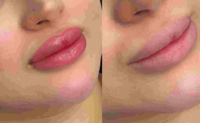 بهترین خدمات فیبروز در برازجون