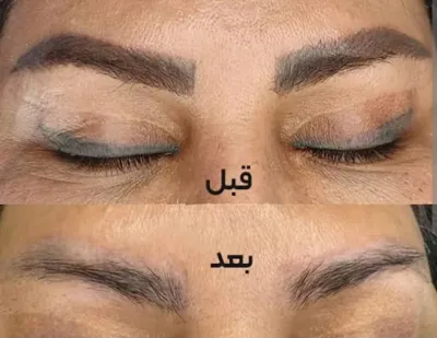 بهترین خدمات فیبروز در برازجون