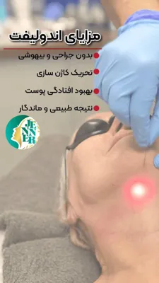 مزایای اندولیف در کرج