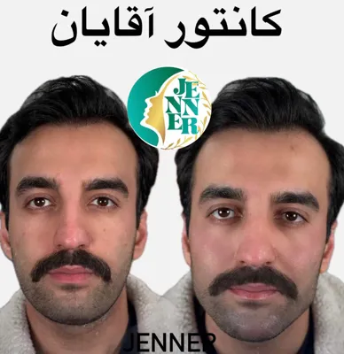 کانتور آقایان در کرج