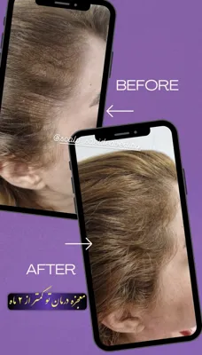 اولين مركز درمان مو و پوست در تهران ايران