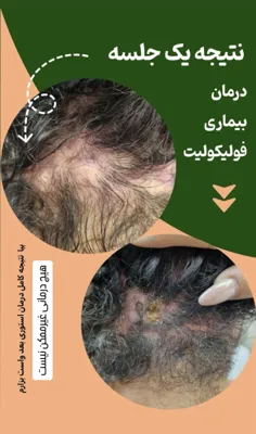 اولين مركز درمان مو و پوست در تهران ايران
