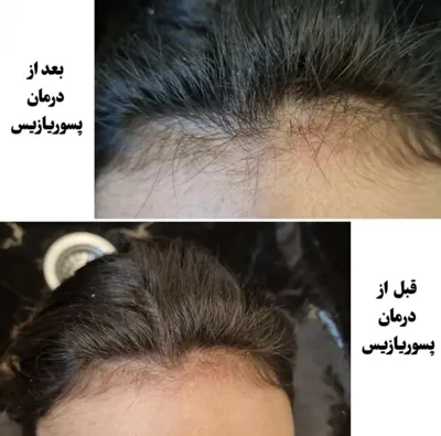 اولين مركز درمان مو و پوست در تهران ايران