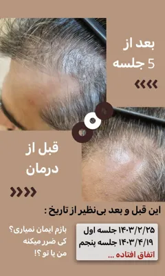 اولين مركز درمان مو و پوست در تهران ايران
