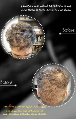 اولين مركز درمان مو و پوست در تهران ايران
