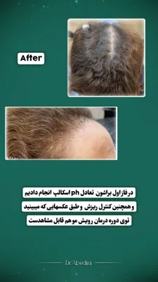 اولين مركز درمان مو و پوست در تهران ايران
