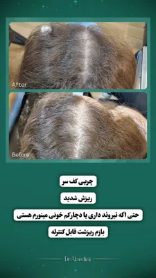 بهترين مركز درمان مو و پوست در غرب تهران