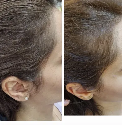 بهترين مركز درمان مو و پوست در غرب تهران
