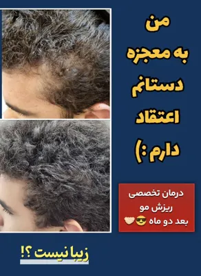 بهترين مركز درمان مو و پوست در غرب تهران
