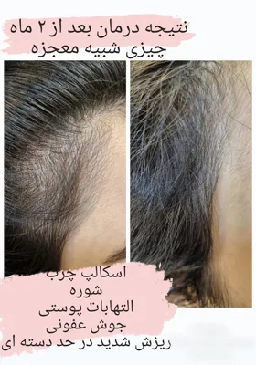 بهترين مركز درمان مو و پوست در غرب تهران
