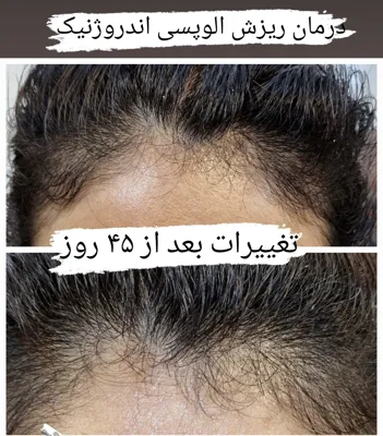 بهترين مركز درمان مو و پوست در غرب تهران
