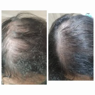 اولين مركز درمان مو و پوست در تهران ايران
