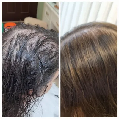 اولين مركز درمان مو و پوست در تهران ايران
