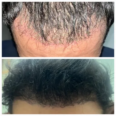 اولين مركز درمان مو و پوست در تهران ايران
