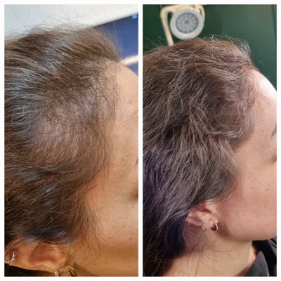 اولين مركز درمان مو و پوست در تهران ايران
