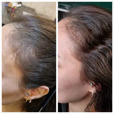 اولين مركز درمان مو و پوست در تهران ايران
