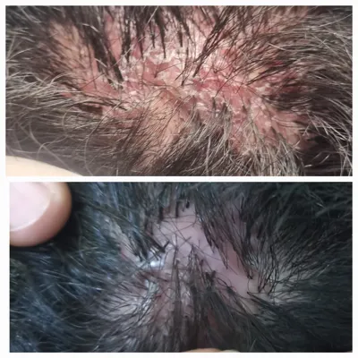 بهترين مركز درمان مو و پوست در تهران ايران
