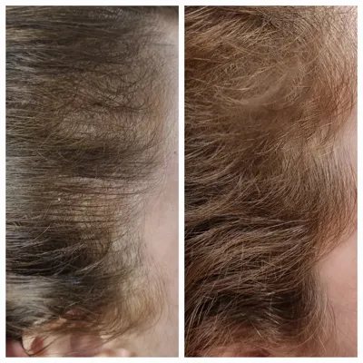 بهترين مركز درمان مو و پوست در تهران ايران
