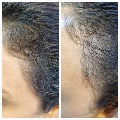 بهترين مركز درمان مو و پوست در تهران ايران
