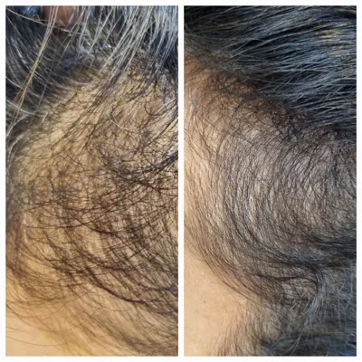 بهترين مركز درمان مو و پوست در غرب تهران
