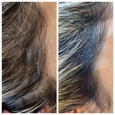 بهترين مركز درمان مو و پوست در غرب تهران
