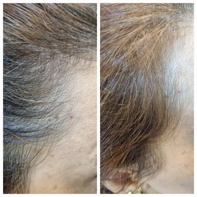 بهترين مركز درمان مو و پوست در غرب تهران
