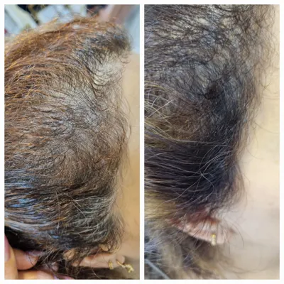 بهترين مركز درمان مو و پوست در غرب تهران