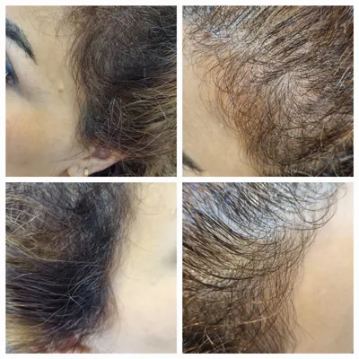 بهترين مركز درمان مو و پوست در غرب تهران
