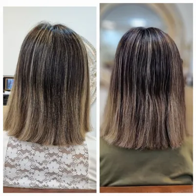 بهترين مركز درمان مو و پوست در غرب تهران
