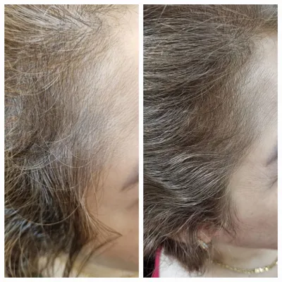 بهترين مركز درمان مو و پوست در تهران ايران
