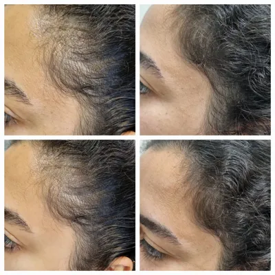 بهترين مركز درمان مو و پوست در تهران ايران
