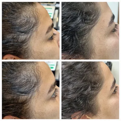 بهترين مركز درمان مو و پوست در تهران ايران
