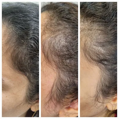 بهترين مركز درمان مو و پوست در تهران ايران
