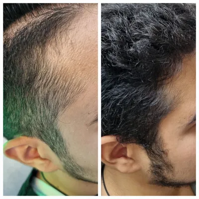 بهترين مركز درمان مو و پوست در تهران ايران
