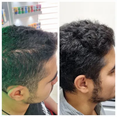 بهترين مركز درمان مو و پوست در تهران ايران
