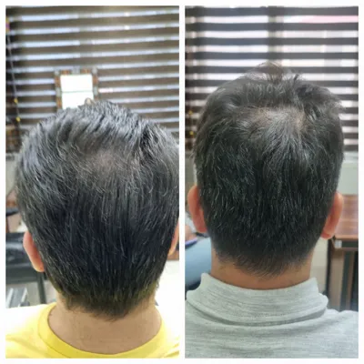 بهترين مركز درمان مو و پوست در غرب تهران