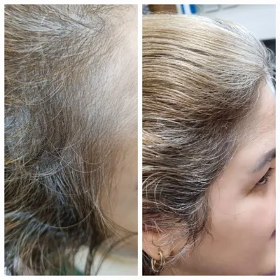 بهترين مركز درمان مو و پوست در غرب تهران
