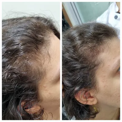 بهترين مركز درمان مو و پوست در غرب تهران
